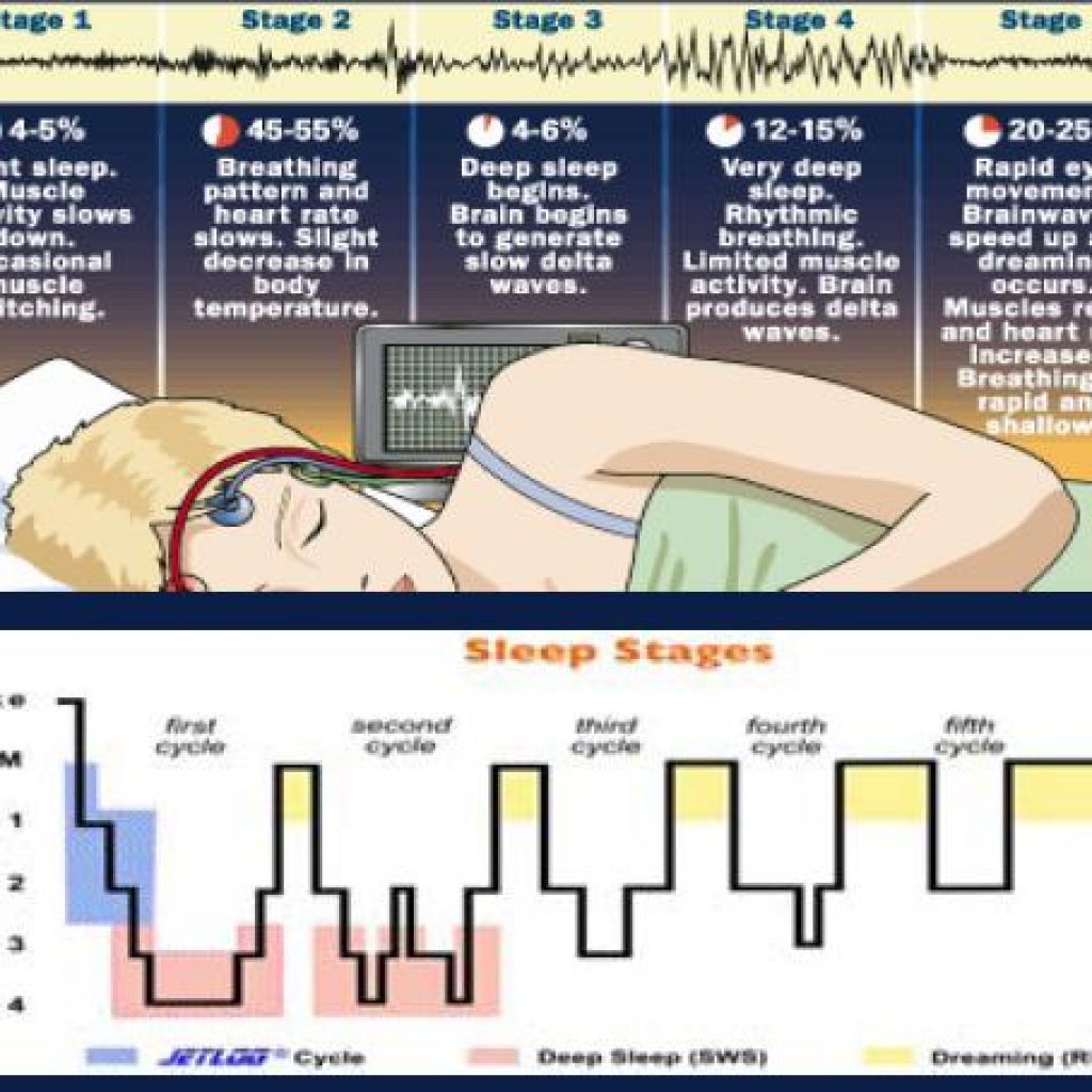 Sleep And Sleep Disorders Caustic Soda Sleep And Sleep Disorders Caustic Soda