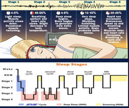 sleep-and-sleep-disorders-caustic-soda