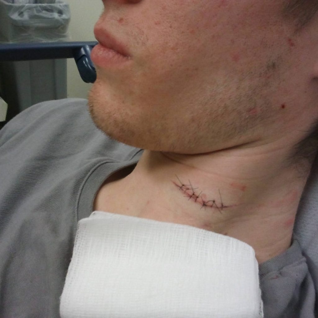 Followups 14 Caustic Soda