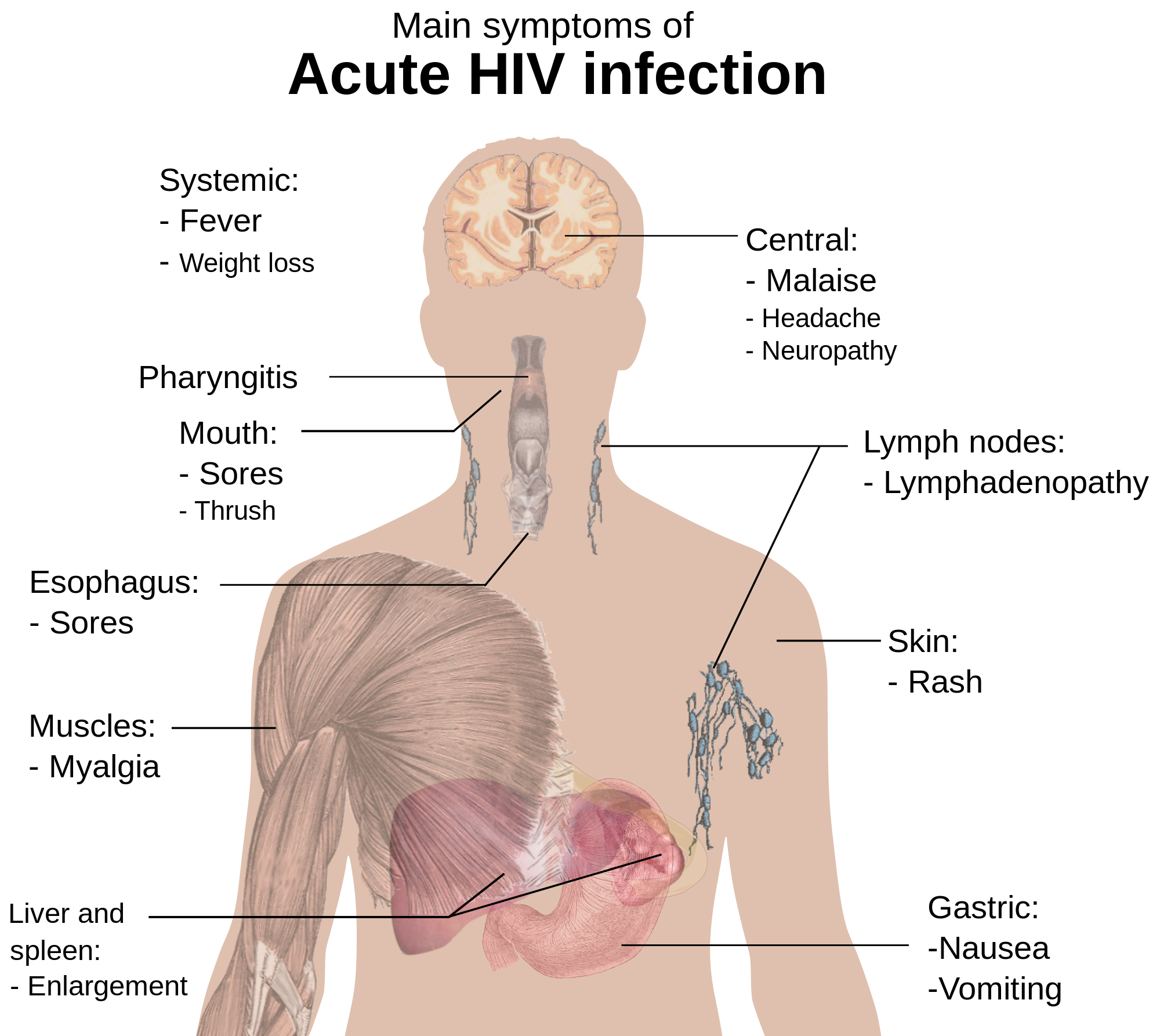 hiv-aids-part-1-caustic-soda